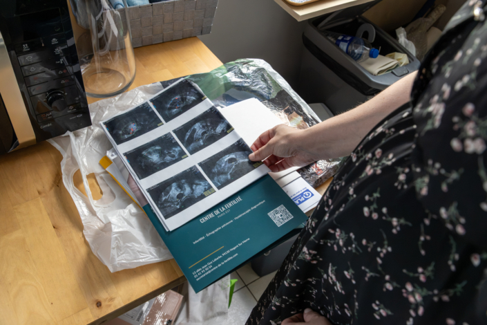 PMA – Échographies de grossesse Nathalie enceinte regarde ses échographies et son dossier médical après son parcours de PMA