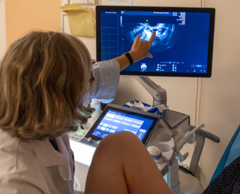 Échographie de contrôle lors d’un parcours de procréation médicalement assistée au CHU de Lille