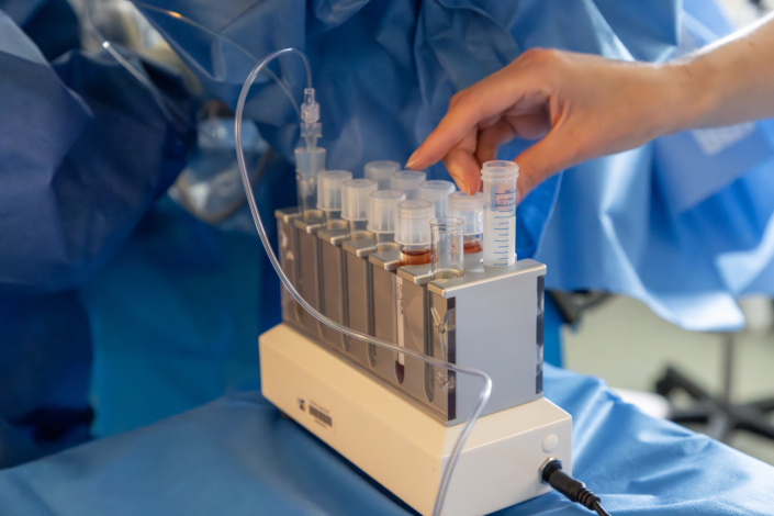 PMA – Recueil des ovocytes Tubes recueillis pendant une ponction d’ovocytes au centre de PMA du CHU de Lille